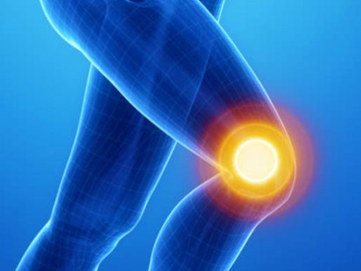 Patellofemoral Pain & Hip Strength