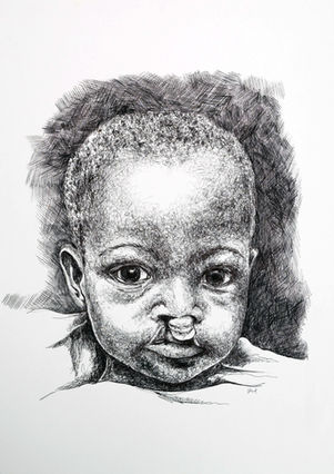 Pen portrait of a young Smile Train patient with a bilateral cleft lip and palate.
