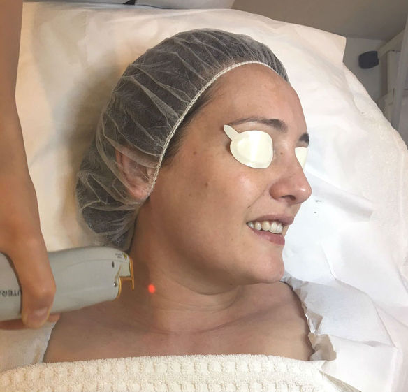 Treatment Lowdown - Lunchtime Laser Facial