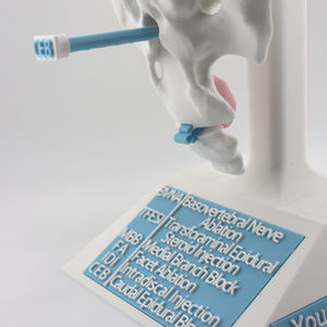 pain-management-procedures-lumbar-pain-model