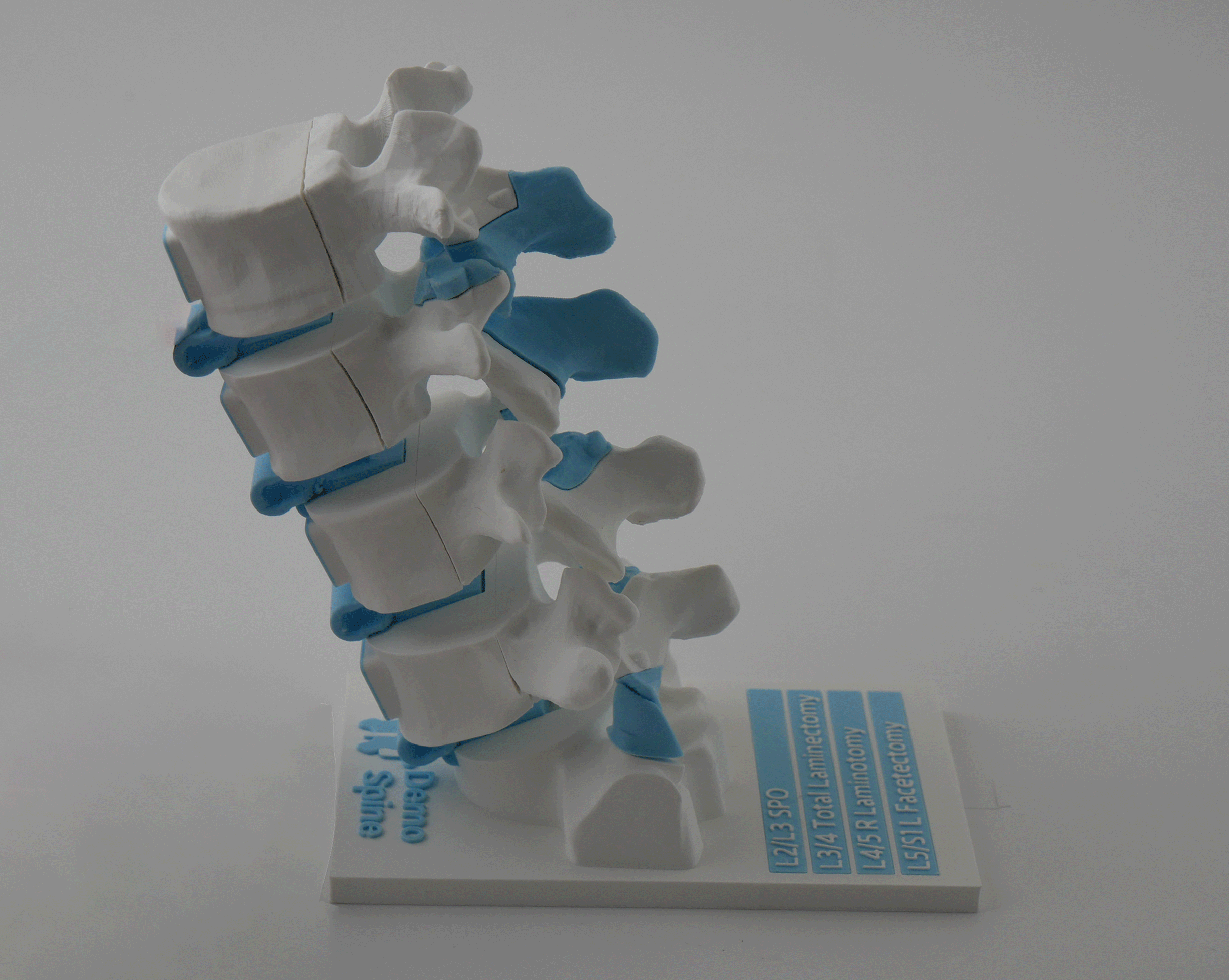 spine-model-articulating-joints