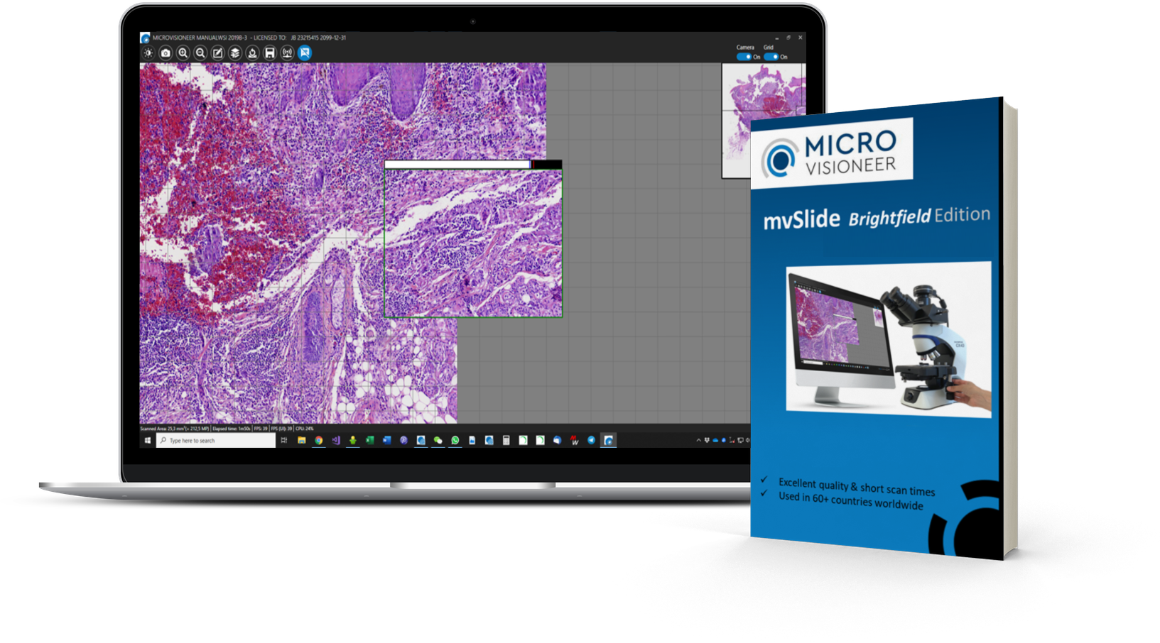 manualWSI is now mvSlide: The ultimate digital microscopy solution