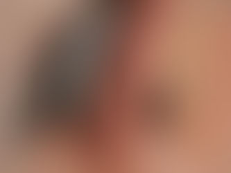 Hearing loss and Tinnitus