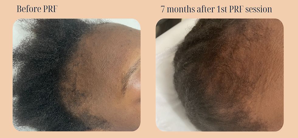 Before and after 01