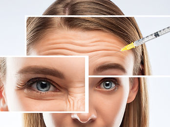 anti-wrinkle.jpg