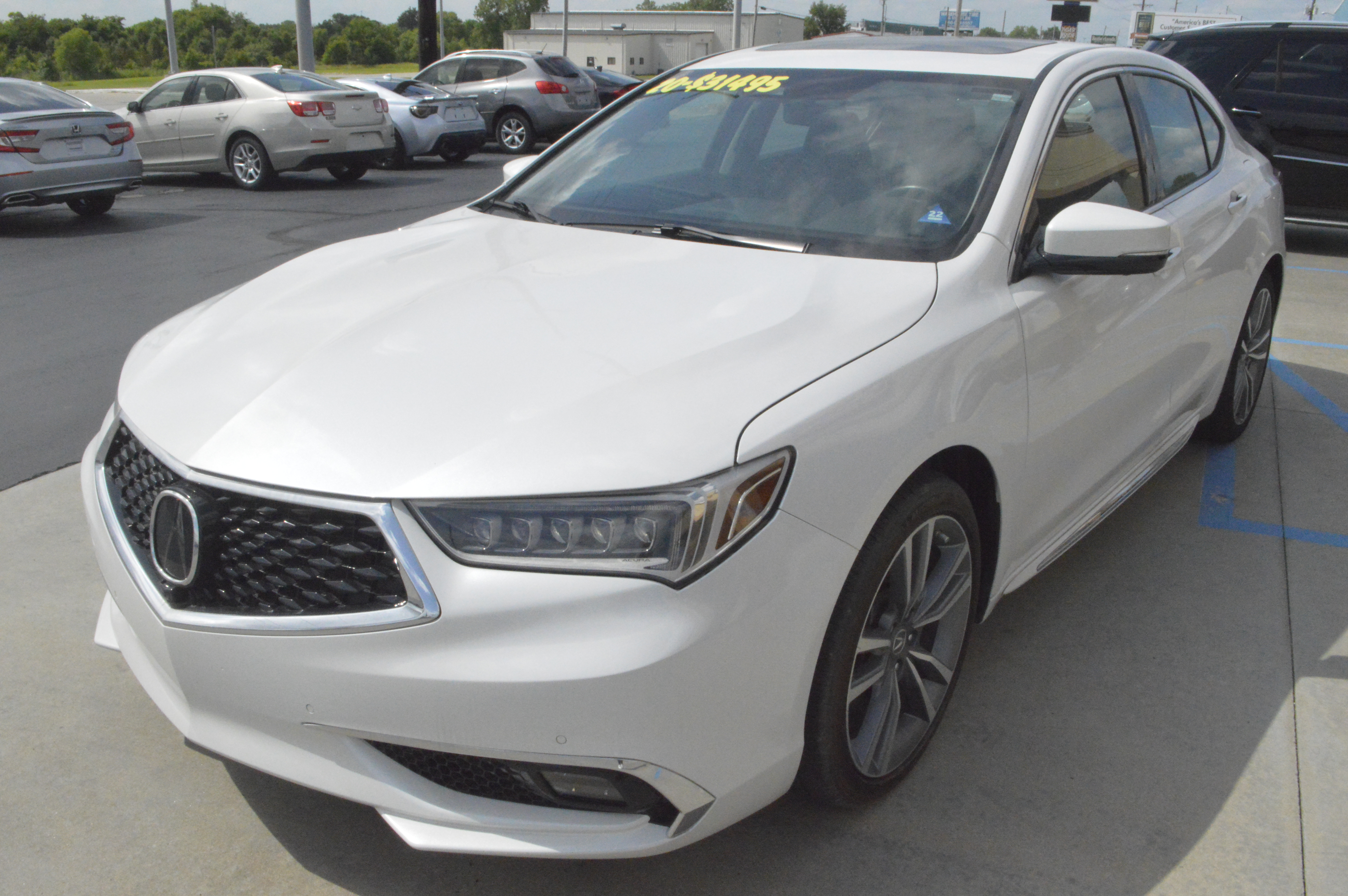 2020 Acura TLX Advance Package's photo