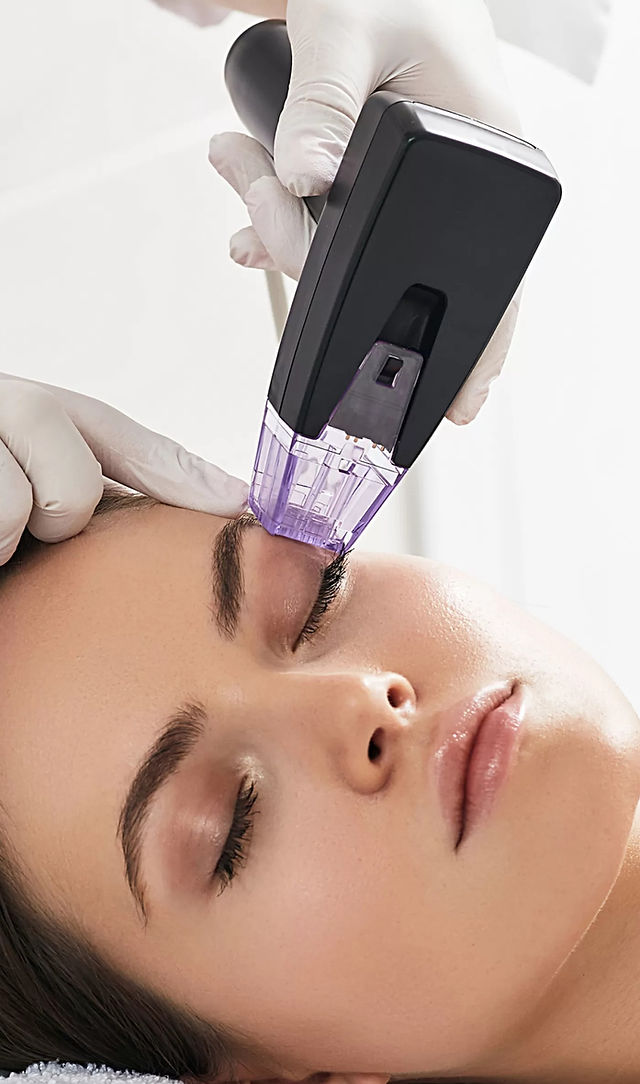 MORPHEUS8 | Laser by Jana Bay