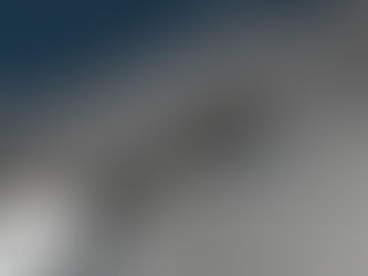 Implantes Dentários: O Que São e Quando São Indicados