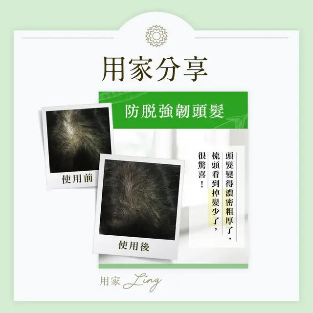 縮圖：豐盛生活 煥髮奇蹟煥肌生髮素(30包裝)