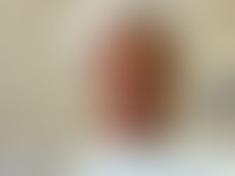 John's health - all change, already