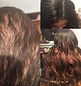 hairloss-gall14-640w.jpg