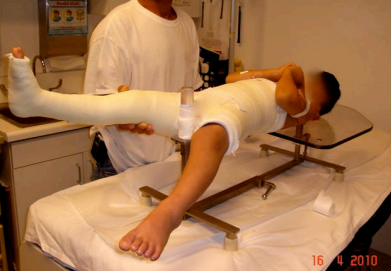Thumbnail: Pediatric Spica Table