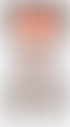 Lipödem Nedir? Lipödem Belirtileri, Evreleri, Tanı ve Güncel Lipödem Tedavi Yöntemleri