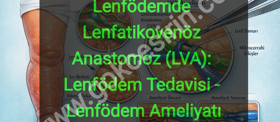 Lenfödemde Lenfatikovenöz Anastomoz (LVA): Lenfödem Tedavisi - Lenfödem Ameliyatı