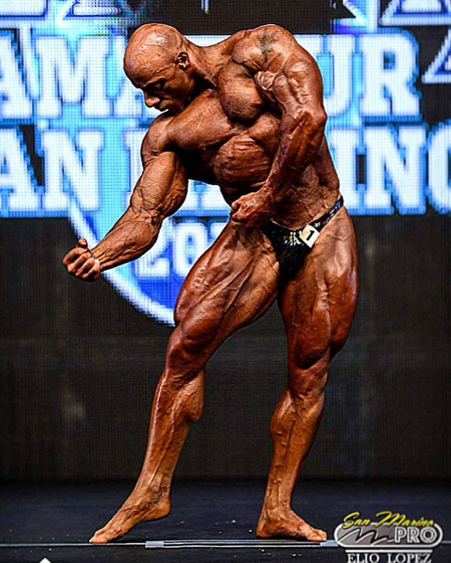TONY MOUNT NAPA (3)