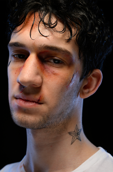 prison fight injuries and tattoos