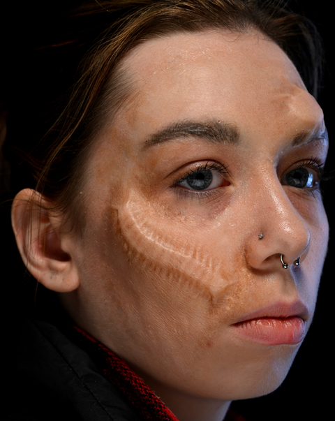 original silicone gfa prosthetic- bugs under skin