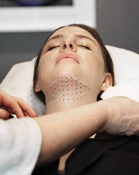 fat-dissolving-injections.jpg