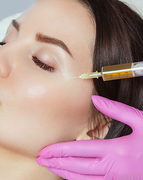 prp vampire facial