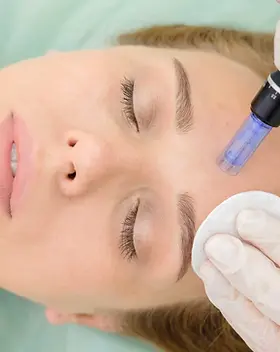 microneedling.webp