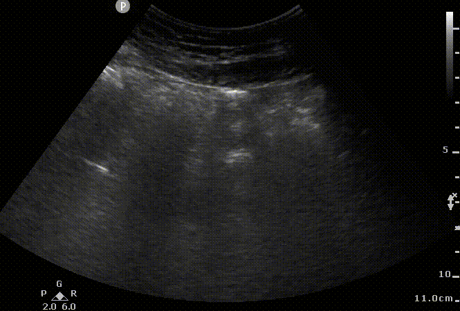 09. nml abdomen.gif