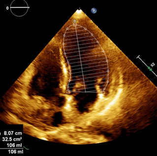 Simpsons calc Ap4c ED.jpg