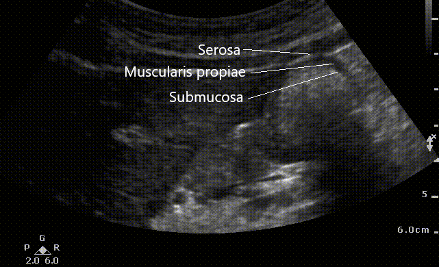 Gastric close up image anatomy.gif