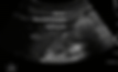 Gastric close up image anatomy.gif