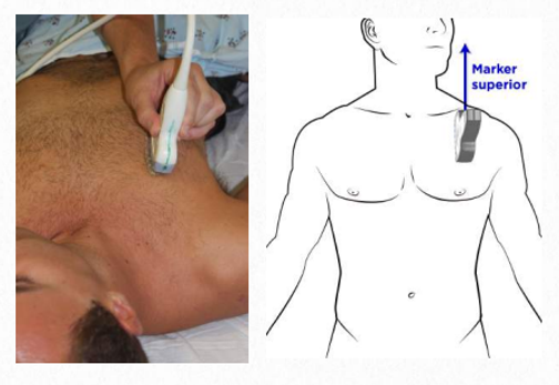 Lung Pleura exam windows.png