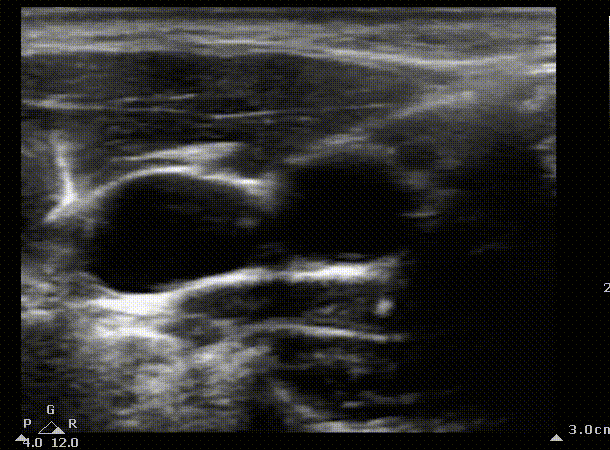 ij scan optimized.gif