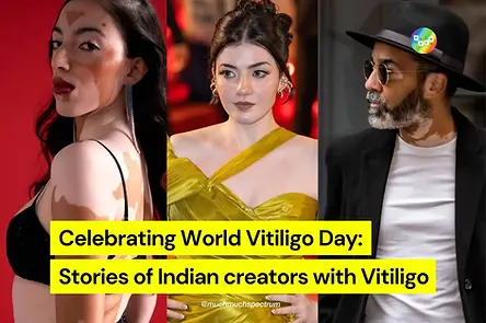 Celebrating World Vitiligo Day: Stories of Indian creators with Vitiligo