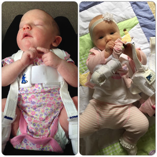 Our Journey With Hip Dysplasia