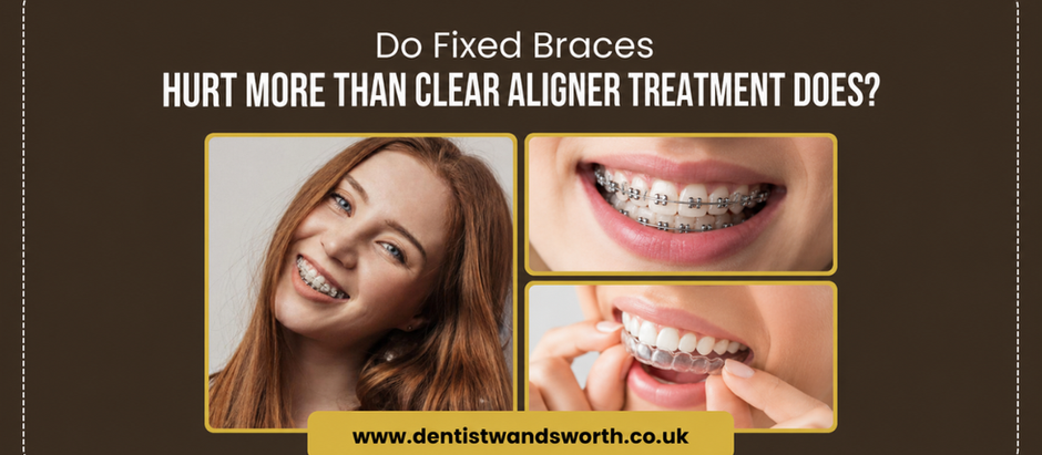 fixed braces London - Dentist Wandsworth