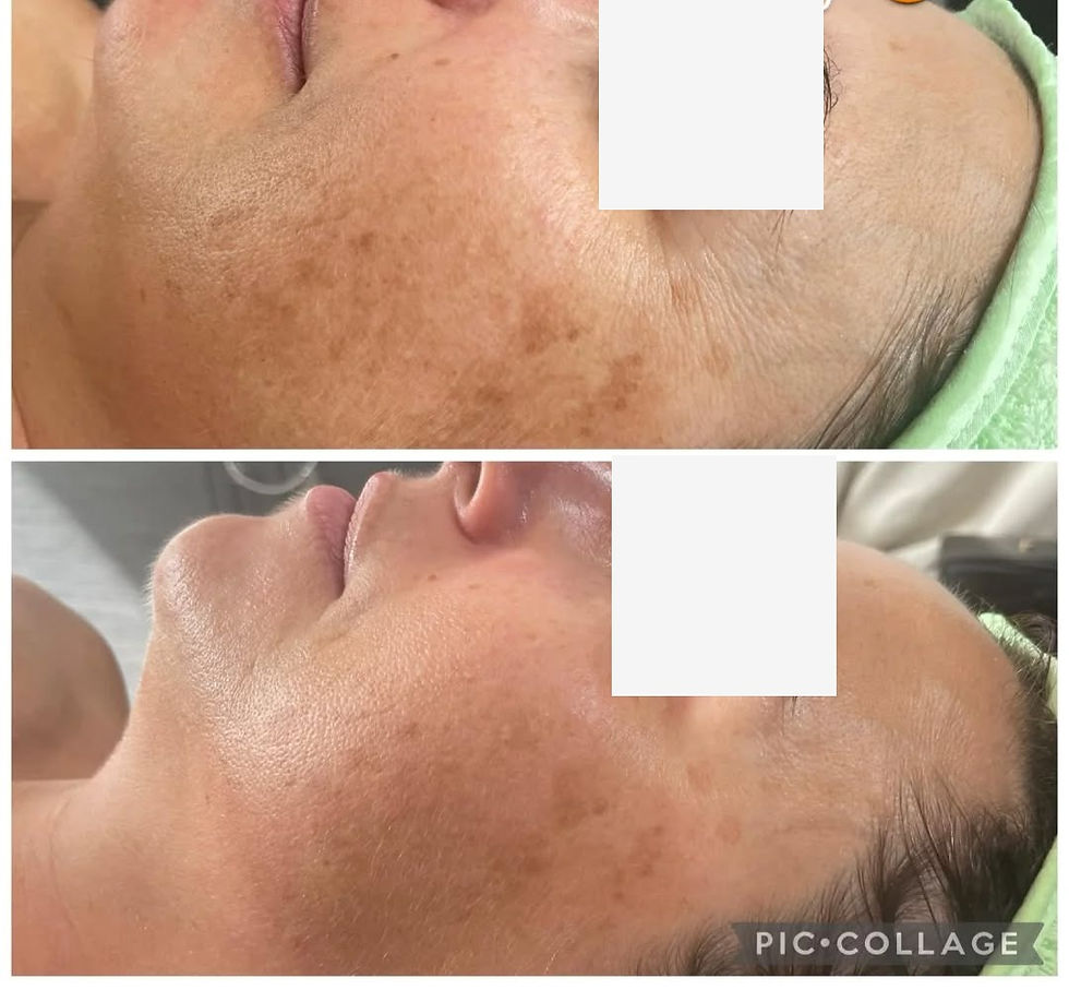 Soin du visage anti-taches anti rides dermo peeling mary cohr