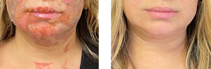 Copy of Treatment provided by Dr. Rios _True Bliss Medical-2.png