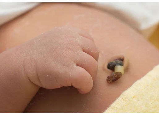 Cuidados com o Cordão Umbilical do Recém-Nascido