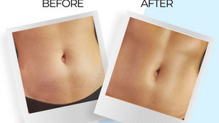 Body Contouring Spray Tanning in Austin