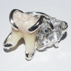 Tooth Ring
