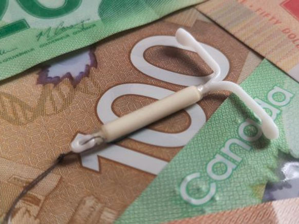 Banner Cash IUD.JPG