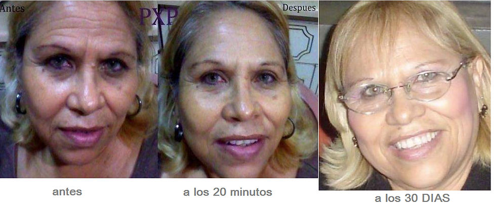 30 dias.png
