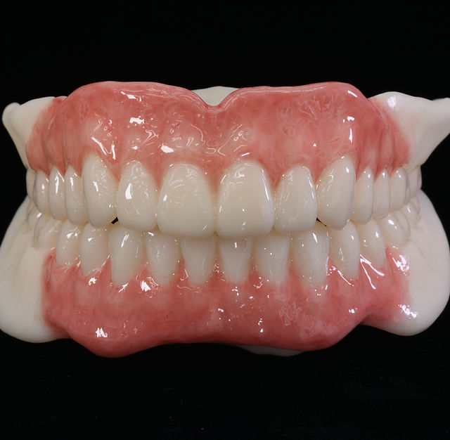 IOSコピーデンチャー | コアデンタルラボ横浜 特設サイト