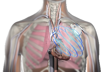 OptiVol_ChestCutAway-2 (1).png