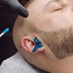Ear Waxing: