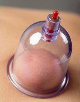 cupping.jpg