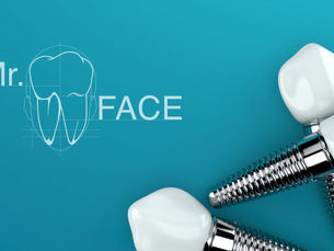 Impianti dentali: perché le pulizie professionali sono la chiave per farli durare nel tempo