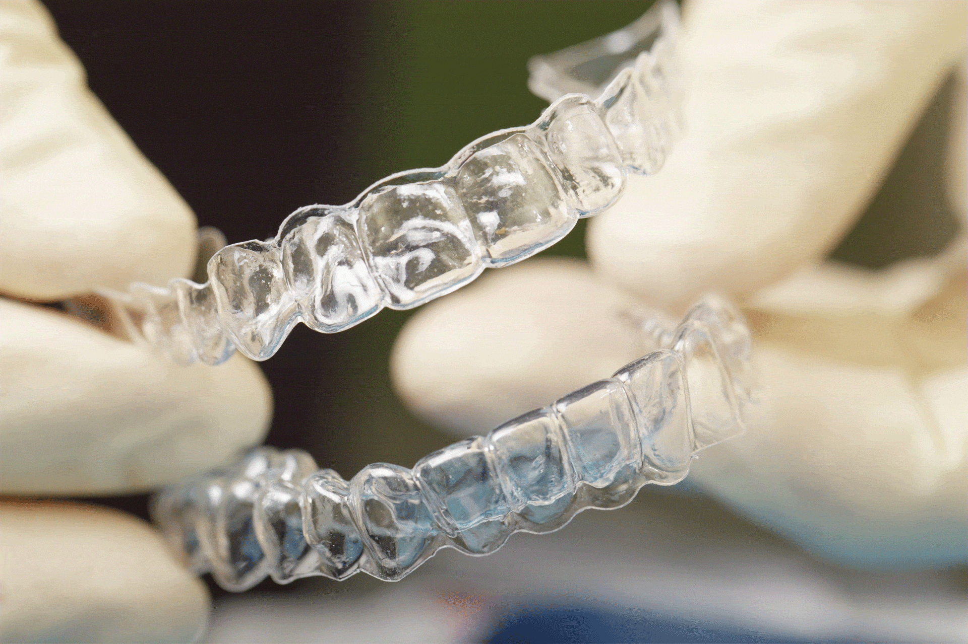 removable-permanent-retainer-options-phoenix-orthodontist.gif