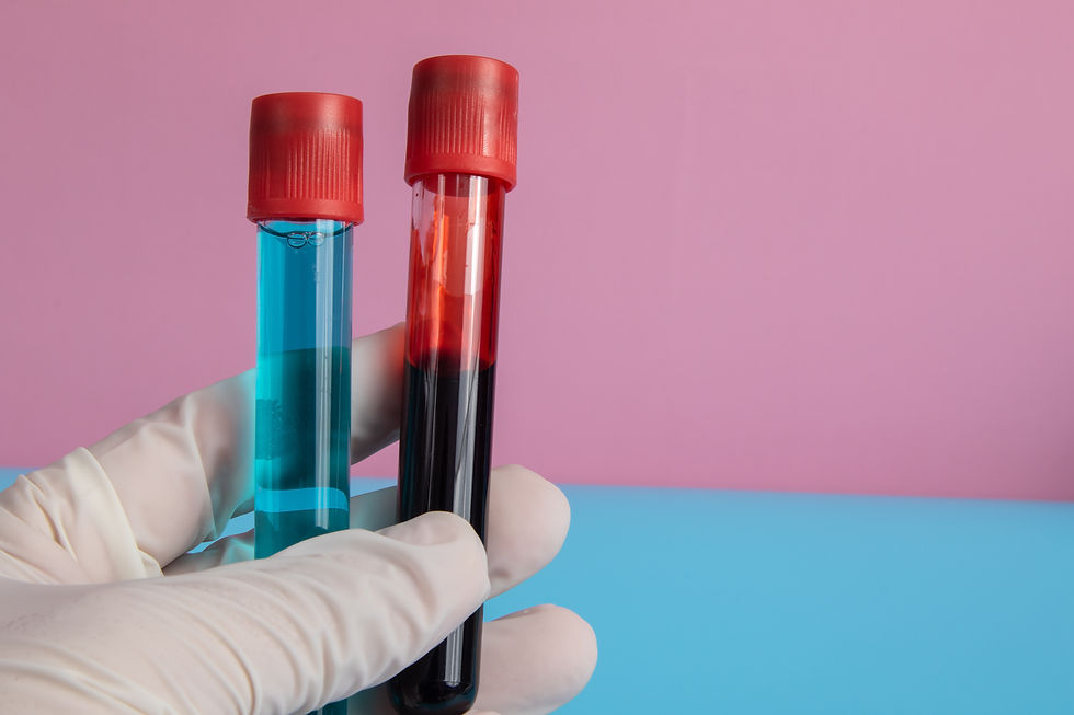 PROTEINAS TOTALES SERICAS