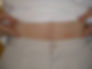 Fleabite on lower stomach get tips on Sterifab