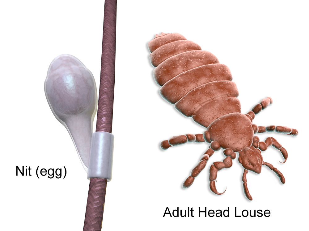 nit and adult head lice image