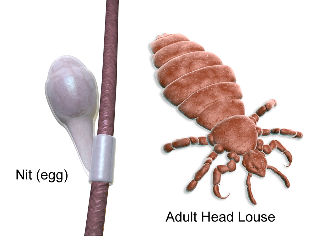 Guide to Lice and Getting Rid of Lice Sterifab Bed Bug Blog